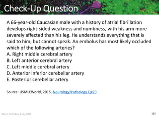 Marc Imhotep Cray MD 123
A 66-year-old Caucasian male with a history of atrial fibrillation
develops right-sided weakness and numbness, with his arm more
severely affected than his leg. He understands everything that is
said to him, but cannot speak. An embolus has most likely occluded
which of the following arteries?
A. Right middle cerebral artery
B. Left anterior cerebral artery
C. Left middle cerebral artery
D. Anterior inferior cerebellar artery
E. Posterior cerebellar artery
Check-Up Question
Source: USMLEWorld, 2015. Neurology/Pathology Q#23.
 