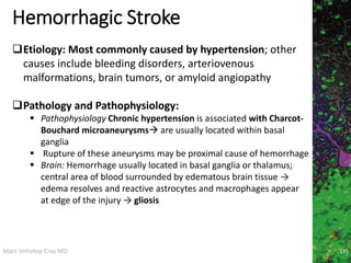 Marc Imhotep Cray MD
Hemorrhagic Stroke
135
Etiology: Most commonly caused by hypertension; other
causes include bleeding disorders, arteriovenous
malformations, brain tumors, or amyloid angiopathy
Pathology and Pathophysiology:
 Pathophysiology Chronic hypertension is associated with Charcot-
Bouchard microaneurysms are usually located within basal
ganglia
 Rupture of these aneurysms may be proximal cause of hemorrhage
 Brain: Hemorrhage usually located in basal ganglia or thalamus;
central area of blood surrounded by edematous brain tissue →
edema resolves and reactive astrocytes and macrophages appear
at edge of the injury → gliosis
 