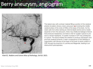 Marc Imhotep Cray MD 144
Berry aneurysm, angiogram
Klatt EC. Robbins and Cotran Atlas of Pathology, 3rd Ed. 2015.
 