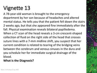Marc Imhotep Cray MD
Vignette 13
147
A 78-year-old woman is brought to the emergency
department by her son because of headaches and altered
mental status. He tells you that the patient fell down the stairs
2 weeks ago, but that she appeared fine immediately after the
fall. Physical examination reveals bilateral papilledema.
When a CT scan of the head reveals a 3-cm crescent-shaped
collection of fluid on the right side of the head that crosses
suture lines with a 7-mm midline shift, you suspect that her
current condition is related to tearing of the bridging veins
between the cerebrum and venous sinuses in the dura and
you schedule her for immediate surgical drainage of the
blood.
What is the Diagnosis?
 