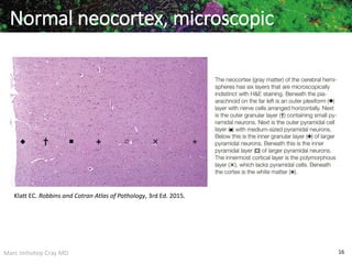 Marc Imhotep Cray MD 16
Normal neocortex, microscopic
Klatt EC. Robbins and Cotran Atlas of Pathology, 3rd Ed. 2015.
 