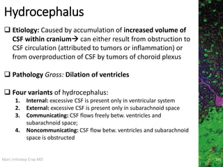 Marc Imhotep Cray MD
Hydrocephalus
160
 Etiology: Caused by accumulation of increased volume of
CSF within cranium can either result from obstruction to
CSF circulation (attributed to tumors or inflammation) or
from overproduction of CSF by tumors of choroid plexus
 Pathology Gross: Dilation of ventricles
 Four variants of hydrocephalus:
1. Internal: excessive CSF is present only in ventricular system
2. External: excessive CSF is present only in subarachnoid space
3. Communicating: CSF flows freely betw. ventricles and
subarachnoid space;
4. Noncommunicating: CSF flow betw. ventricles and subarachnoid
space is obstructed
 