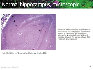 Marc Imhotep Cray MD 17
Normal hippocampus, microscopic
Klatt EC. Robbins and Cotran Atlas of Pathology, 3rd Ed. 2015.
 