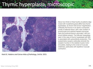 Marc Imhotep Cray MD 171
Thymic hyperplasia, microscopic
Klatt EC. Robbins and Cotran Atlas of Pathology, 3rd Ed. 2015.
 