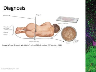 Marc Imhotep Cray MD
Diagnosis
193
Runge MS and Greganti MA. Netter's Internal Medicine 2nd Ed. Saunders 2008.
 