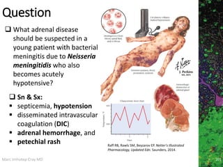 Marc Imhotep Cray MD
Question
 What adrenal disease
should be suspected in a
young patient with bacterial
meningitis due to Neisseria
meningitidis who also
becomes acutely
hypotensive?
 Sn & Sx:
 septicemia, hypotension
 disseminated intravascular
coagulation (DIC)
 adrenal hemorrhage, and
 petechial rash Raff RB, Rawls SM, Beyzarov EP. Netter's Illustrated
Pharmacology, Updated Edn. Saunders, 2014.
201
 