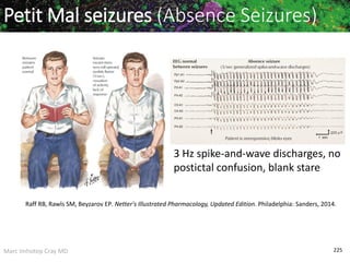 Marc Imhotep Cray MD 225
Petit Mal seizures (Absence Seizures)
Raff RB, Rawls SM, Beyzarov EP. Netter's Illustrated Pharmacology, Updated Edition. Philadelphia: Sanders, 2014.
3 Hz spike-and-wave discharges, no
postictal confusion, blank stare
 