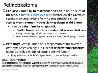 Marc Imhotep Cray MD
Retinoblastoma
237
 Etiology: Caused by homozygous deletion in both alleles of
RB gene, a tumor-suppressor gene located on chr 13, which
results in a tumor arising from neuroepithelial cells in
retina; most common intraocular neoplasm of childhood
 Can be either familial or sporadic
o Familial form is transmitted as autosomal dominant trait even
though homozygosity is necessary for disease
o Over 90% of heterozygous carriers end up developing disease
 Pathology Retina: Round cells w hyperchromatic nuclei &
little cytoplasm arranged in Flexner Wintersteiner rosettes
(cuboidal cells positioned around central lumen)
 May metastasize to brain, spinal cord, bone, or lymph nodes
DDx of Flexner rosettes:
Neuroblastomas have Homer-Wright rosettes tumor cells surrounding neuropil
Ependymal rosettes, found in Ependymoma tumor cells w an empty lumen
 