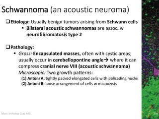 Marc Imhotep Cray MD
Schwannoma (an acoustic neuroma)
258
Etiology: Usually benign tumors arising from Schwann cells
 Bilateral acoustic schwannomas are assoc. w
neurofibromatosis type 2
Pathology:
 Gross: Encapsulated masses, often with cystic areas;
usually occur in cerebellopontine angle where it can
compress cranial nerve VIII (acoustic schwannoma)
Microscopic: Two growth patterns:
(1) Antoni A: tightly packed elongated cells with palisading nuclei
(2) Antoni B: loose arrangement of cells w microcysts
 