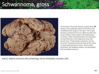 Marc Imhotep Cray MD 260
Schwannoma, gross
Klatt EC. Robbins and Cotran Atlas of Pathology, 3rd Ed. Philadelphia: Saunders, 2015.
 