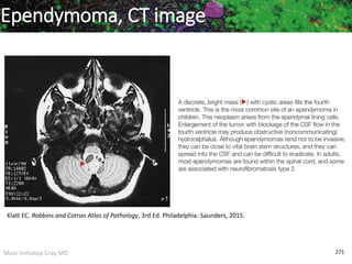 Marc Imhotep Cray MD 271
Ependymoma, CT image
Klatt EC. Robbins and Cotran Atlas of Pathology, 3rd Ed. Philadelphia: Saunders, 2015.
 
