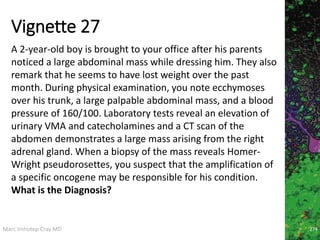 Marc Imhotep Cray MD
Vignette 27
274
A 2-year-old boy is brought to your office after his parents
noticed a large abdominal mass while dressing him. They also
remark that he seems to have lost weight over the past
month. During physical examination, you note ecchymoses
over his trunk, a large palpable abdominal mass, and a blood
pressure of 160/100. Laboratory tests reveal an elevation of
urinary VMA and catecholamines and a CT scan of the
abdomen demonstrates a large mass arising from the right
adrenal gland. When a biopsy of the mass reveals Homer-
Wright pseudorosettes, you suspect that the amplification of
a specific oncogene may be responsible for his condition.
What is the Diagnosis?
 