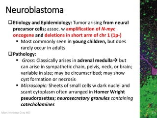 Marc Imhotep Cray MD
Neuroblastoma
275
Etiology and Epidemiology: Tumor arising from neural
precursor cells; assoc. w amplification of N-myc
oncogene and deletions in short arm of chr 1 (1p-)
 Most commonly seen in young children, but does
rarely occur in adults
Pathology:
 Gross: Classically arises in adrenal medulla but
can arise in sympathetic chain, pelvis, neck, or brain;
variable in size; may be circumscribed; may show
cyst formation or necrosis
 Microscopic: Sheets of small cells w dark nuclei and
scant cytoplasm often arranged in Homer Wright
pseudorosettes; neurosecretory granules containing
catecholamines
 
