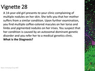 Marc Imhotep Cray MD
Vignette 28
279
A 14-year-old girl presents to your clinic complaining of
multiple nodules on her skin. She tells you that her mother
suffers from a similar condition. Upon further examination,
you find multiple coffee-colored macules on her torso and
limbs and pigmented nodules on her irises. You suspect that
her condition is caused by an autosomal dominant genetic
disorder and you refer her to a medical genetics clinic.
What is the Diagnosis?
 