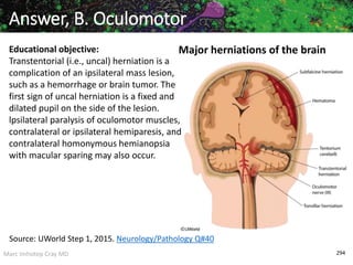 Marc Imhotep Cray MD 294
Answer, B. Oculomotor
Major herniations of the brainEducational objective:
Transtentorial (i.e., uncal) herniation is a
complication of an ipsilateral mass lesion,
such as a hemorrhage or brain tumor. The
first sign of uncal herniation is a fixed and
dilated pupil on the side of the lesion.
lpsilateral paralysis of oculomotor muscles,
contralateral or ipsilateral hemiparesis, and
contralateral homonymous hemianopsia
with macular sparing may also occur.
Source: UWorld Step 1, 2015. Neurology/Pathology Q#40
 