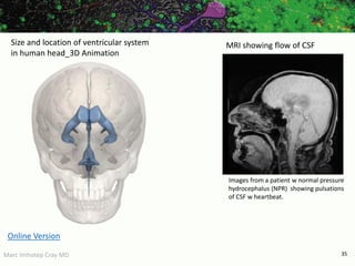 Marc Imhotep Cray MD 35
MRI showing flow of CSF
Images from a patient w normal pressure
hydrocephalus (NPR) showing pulsations
of CSF w heartbeat.
Size and location of ventricular system
in human head_3D Animation
Online Version
 