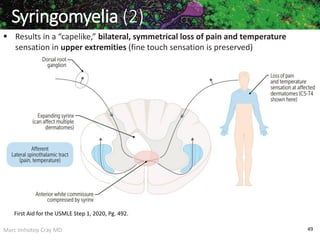 Marc Imhotep Cray MD 49
 Results in a “capelike,” bilateral, symmetrical loss of pain and temperature
sensation in upper extremities (fine touch sensation is preserved)
Syringomyelia (2)
First Aid for the USMLE Step 1, 2020, Pg. 492.
 