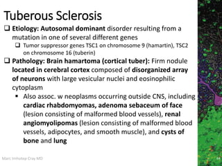 Marc Imhotep Cray MD
Tuberous Sclerosis
64
 Etiology: Autosomal dominant disorder resulting from a
mutation in one of several different genes
 Tumor suppressor genes TSC1 on chromosome 9 (hamartin), TSC2
on chromosome 16 (tuberin)
 Pathology: Brain hamartoma (cortical tuber): Firm nodule
located in cerebral cortex composed of disorganized array
of neurons with large vesicular nuclei and eosinophilic
cytoplasm
 Also assoc. w neoplasms occurring outside CNS, including
cardiac rhabdomyomas, adenoma sebaceum of face
(lesion consisting of malformed blood vessels), renal
angiomyolipomas (lesion consisting of malformed blood
vessels, adipocytes, and smooth muscle), and cysts of
bone and lung
 