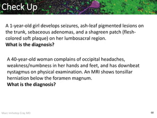 Marc Imhotep Cray MD 68
A 1-year-old girl develops seizures, ash-leaf pigmented lesions on
the trunk, sebaceous adenomas, and a shagreen patch (flesh-
colored soft plaque) on her lumbosacral region.
What is the diagnosis?
Check Up
A 40-year-old woman complains of occipital headaches,
weakness/numbness in her hands and feet, and has downbeat
nystagmus on physical examination. An MRI shows tonsillar
herniation below the foramen magnum.
What is the diagnosis?
 