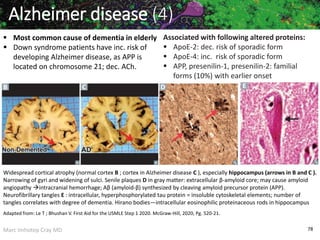 Marc Imhotep Cray MD 78
Widespread cortical atrophy (normal cortex B ; cortex in Alzheimer disease C ), especially hippocampus (arrows in B and C ).
Narrowing of gyri and widening of sulci. Senile plaques D in gray matter: extracellular β-amyloid core; may cause amyloid
angiopathy intracranial hemorrhage; Aβ (amyloid-β) synthesized by cleaving amyloid precursor protein (APP).
Neurofibrillary tangles E : intracellular, hyperphosphorylated tau protein = insoluble cytoskeletal elements; number of
tangles correlates with degree of dementia. Hirano bodies—intracellular eosinophilic proteinaceous rods in hippocampus
 Most common cause of dementia in elderly
 Down syndrome patients have inc. risk of
developing Alzheimer disease, as APP is
located on chromosome 21; dec. ACh.
Alzheimer disease (4)
Associated with following altered proteins:
 ApoE-2: dec. risk of sporadic form
 ApoE-4: inc. risk of sporadic form
 APP, presenilin-1, presenilin-2: familial
forms (10%) with earlier onset
Adapted from: Le T ; Bhushan V. First Aid for the USMLE Step 1 2020. McGraw-Hill, 2020, Pg. 520-21.
 