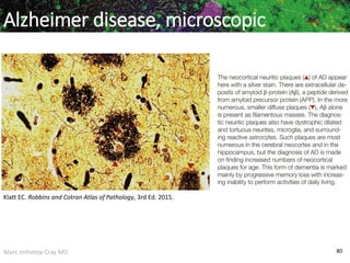 Marc Imhotep Cray MD 80
Alzheimer disease, microscopic
Klatt EC. Robbins and Cotran Atlas of Pathology, 3rd Ed. 2015.
 