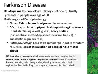 Marc Imhotep Cray MD
Parkinson Disease
92
Etiology and Epidemiology: Etiology unknown; Usually
presents in people over age of 50
Pathology and Pathophysiology
 Gross: Pale substantia nigra and locus ceruleus
 Microscopic: Loss of pigmented dopaminergic neurons
in substantia nigra with gliosis; Lewy bodies
(eosinophilic, intracytoplasmic inclusion bodies) in
substantia nigra neurons
 Pathophysiology: Loss of dopaminergic input to striatum
results in loss of stimulation of basal ganglia motor
circuit
NB: Lewy body dementia, also known as dementia w Lewy bodies, is
second most common type of progressive dementia after AD dementia.
Protein deposits, called Lewy bodies, develop in nerve cells in brain
regions involved in thinking, memory and movement (motor control).
 
