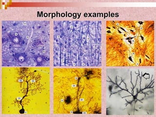 Morphology examples
 