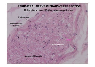 PERIPHERAL NERVE IN TRANSVERSE SECTION
               72. Peripheral nerve, HE. (low power magnification)


        Perineurium


Schwann-cell
  nucleus




                                                            Axon

                                            Myelin sheath




               Nucleus of fibrocyte
 
