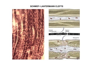 SCHMIDT- LANTERMANN CLEFTS
 