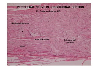PERIPHERAL NERVE IN LONGITUDINAL SECTION
                        73. Peripheral nerve, HE.




Nucleus of fibrocyte




                       Node of Ranvier              Schwann cell
                                                      nucleus

         Axon
 