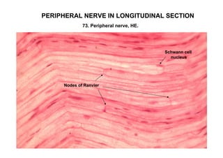 PERIPHERAL NERVE IN LONGITUDINAL SECTION
             73. Peripheral nerve, HE.




                                         Schwann cell
                                           nucleus




     Nodes of Ranvier
 