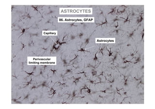 ASTROCYTES
                     86. Astrocytes, GFAP


         Capillary

                                            Astrocytes




   Perivascular
limiting membrane
 