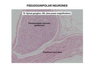 PSEUDOUNIPOLAR NEURONES

76. Spinal ganglion, HE. (low power magnification)



     Pseudounipolar neurones
           (perikaryon)




                     Peripheral nerve fibers
 