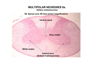 MULTIPOLAR NEURONES IIa.
               Deiters motoneurones

  80. Spinal cord, HE (low power magnification)


                 Central canal




                           Gray matter




White matter

                     Ventral horn
               (Deiters motoneurones)
 