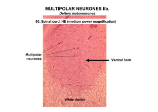 MULTIPOLAR NEURONES IIb.
                    Deiters motoneurones

      80. Spinal cord, HE (medium power magnification)




Multipolar
neurones                                           Ventral horn




                       White matter
 