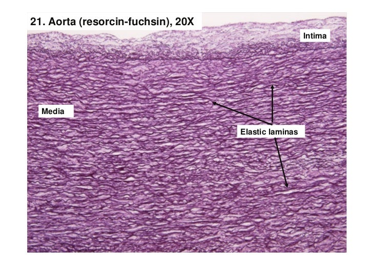 Nervous tissue ii