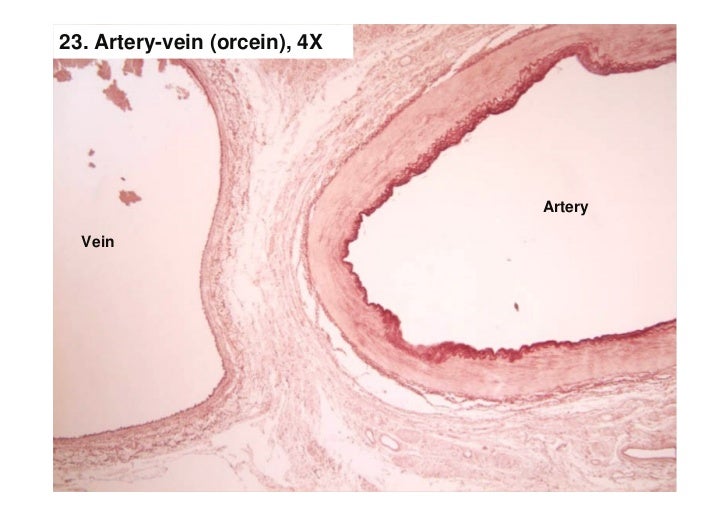 Nervous Tissue Ii Nervous Tissue Ii