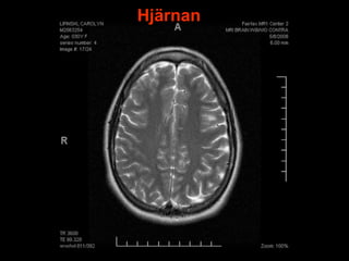 Hjärnan




          7
 