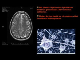 Det yttersta i hjärnan dvs hjärnbarken
består av grå substans. Nerv cellernas
cellkärnor.

   Medan det inre består av vit substans vilket
är cellernas ledningsbanor.




                        Text




                                 10
 