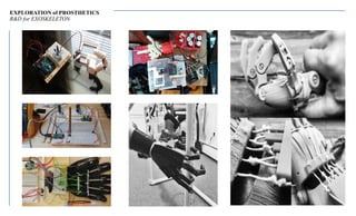 EXPLORATION of PROSTHETICS
R&D for EXOSKELETON
 