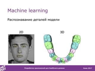 Киев 2017
Machine learning
Распознавание деталей модели
Разработка приложений для healthcare домена
2D 3D
 