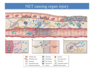 NET causing organ injury
 