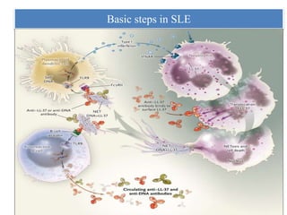 Basic steps in SLE
 