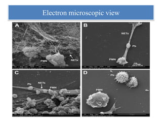 Electron microscopic view
 