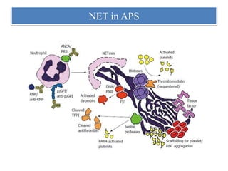 NET in APS
 