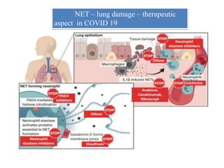 NET – lung damage – therapeutic
aspect in COVID 19
 