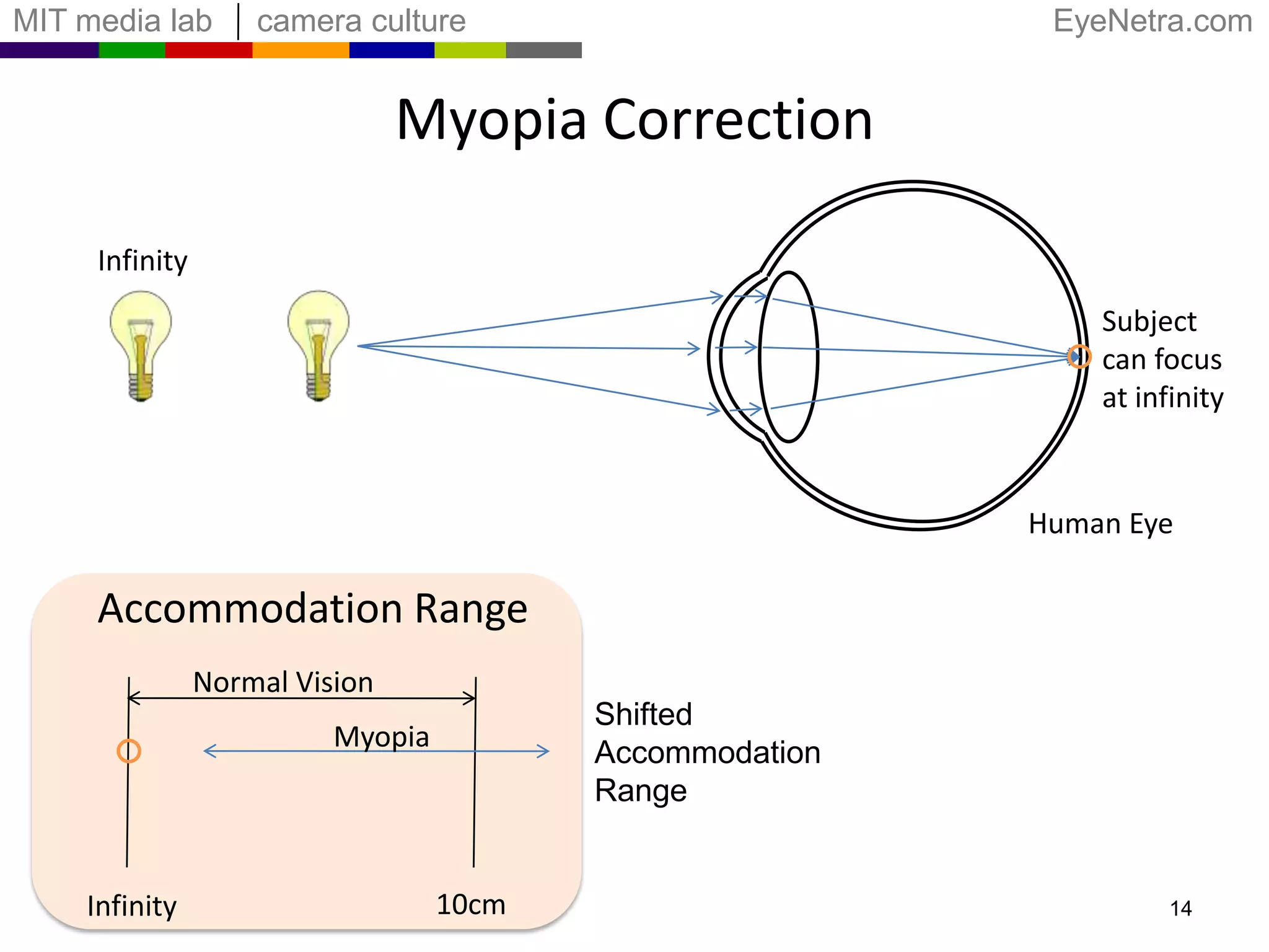Myopia CorrectionInfinitySubject can focusat infinityHuman EyeAccommodation RangeNormal VisionShifted Accommodation RangeMyopia10cmInfinity14