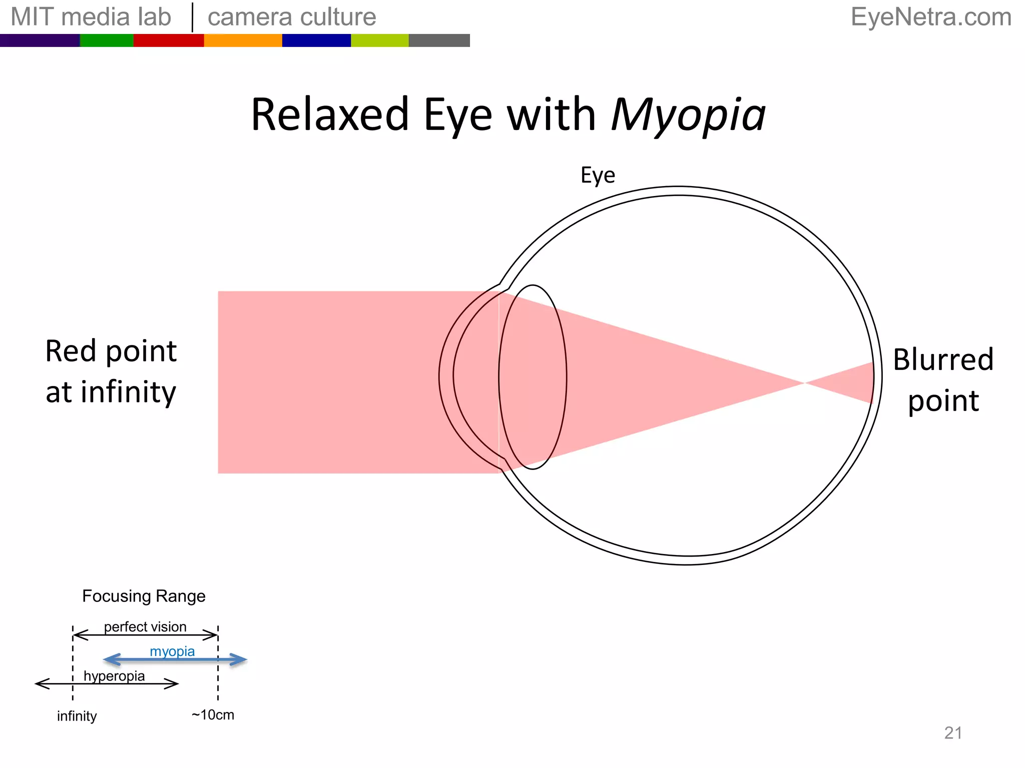Refractive Errors and Shifted RangePerfect visionNeed to measureMyopiaHyperopia10cmInfinity191m33cmDistance