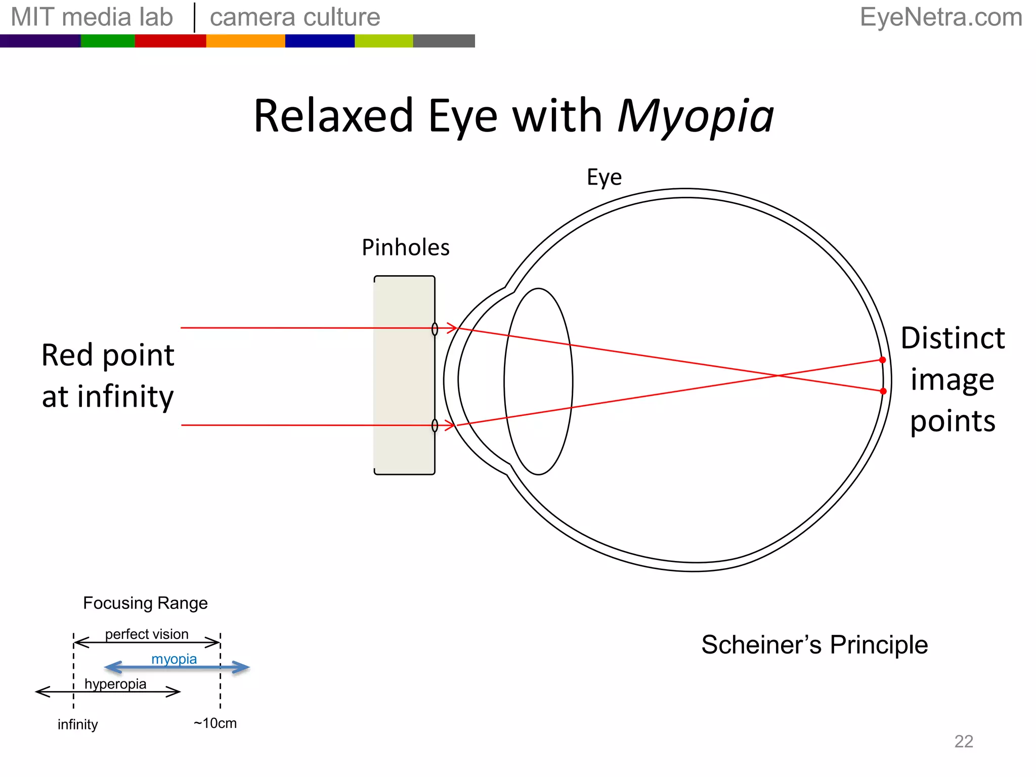 Refractive Errors and Shifted RangePerfect visionMyopiaHyperopia10cmInfinity201m33cmDistance10D0D3D1D-1D-3DDiopterDiopter = 1/Distance