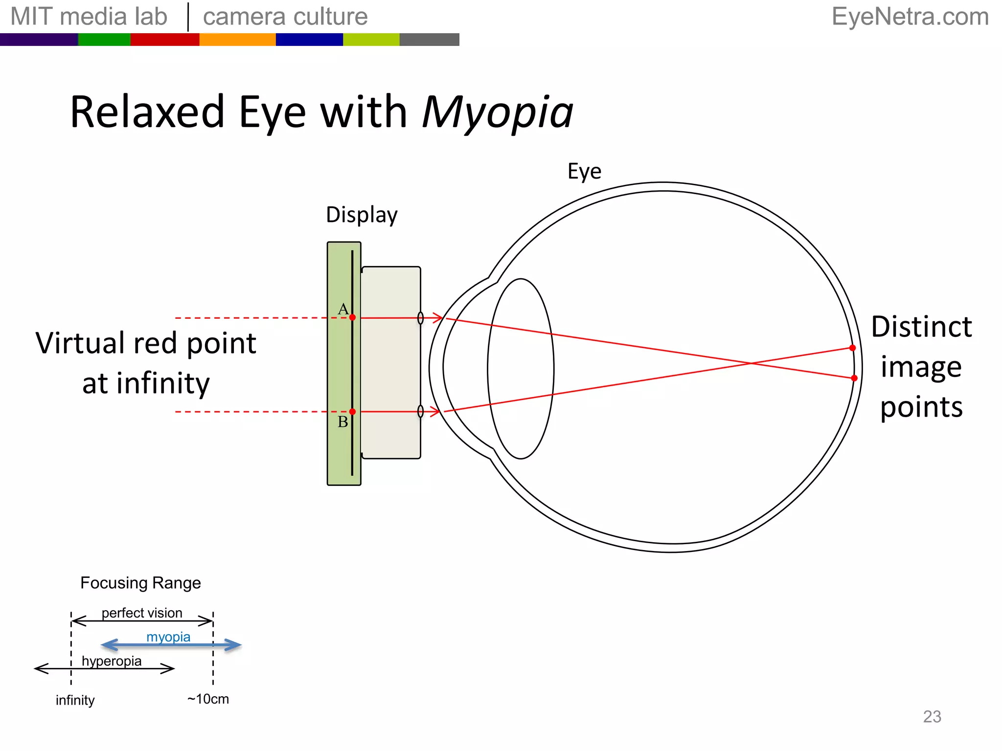 Relaxed Eye with MyopiaEyeRed pointat infinityBlurred pointFocusing Rangeperfect visionmyopiahyperopia~10cminfinity21